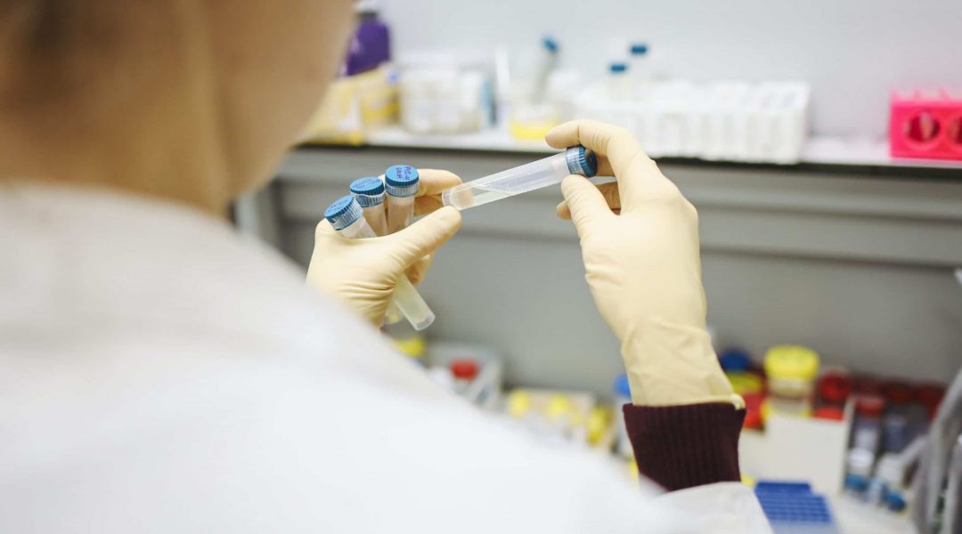 Lab technician checkin PCR tests